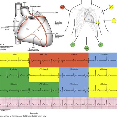 ecg 12 lead normal|12 lead ecg interpretation chart.